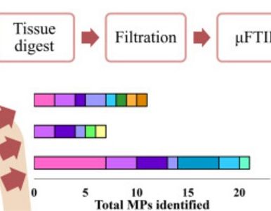 Detection of microplastics in human lung tissue using μFTIR spectroscopy
