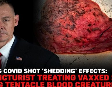 Shocking Covid Shot ‘Shedding’ Effects: Acupuncturist Treating Vaxxed Starts Passing Parasites
