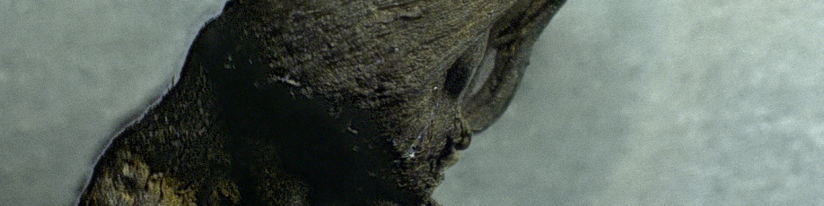 EXCLUSIVE: Shocking microscopy photos of blood clots extracted from those who “suddenly died” – crystalline structures, nanowires, chalky particles and fibrous structures