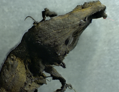 EXCLUSIVE: Shocking microscopy photos of blood clots extracted from those who “suddenly died” – crystalline structures, nanowires, chalky particles and fibrous structures